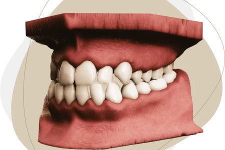 3D treatment planning in orthodontics