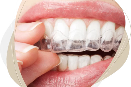 Przezroczysty aparat ortodontyczny – czy jest lepszy od metalowego?