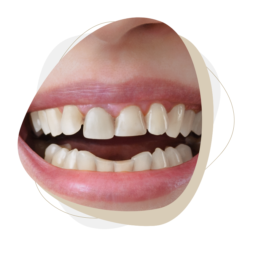 teeth 1