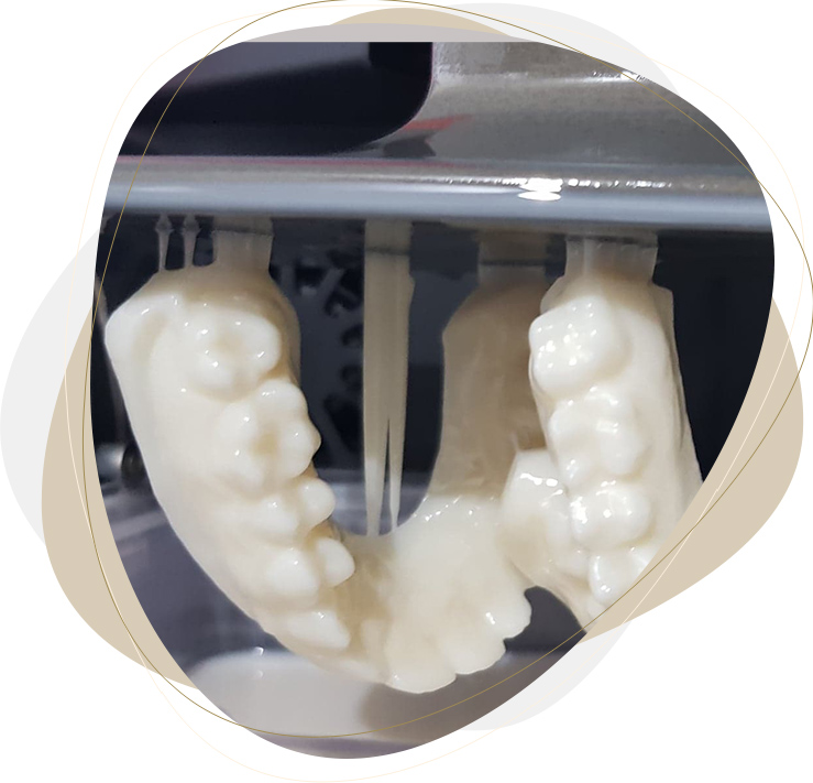 nakładka ortodontyczna na zęby- druk3D